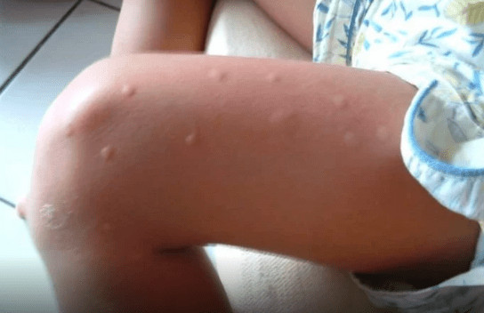 KOMARCI VAM PRAVE PAKAO OD ŽIVOTA? Samo isijecite OVO VOĆE na pola i ostavite u sobi, VIŠE IH NIKADA NEĆETE VIDJETI BLIZU! - featured image KOMARCI VAM PRAVE PAKAO OD ŽIVOTA? Samo isijecite OVO VOĆE na pola i ostavite u sobi, VIŠE IH NIKADA NEĆETE VIDJETI BLIZU! - featured image